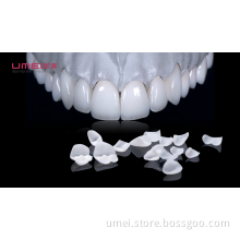 Hollywood White Veneers